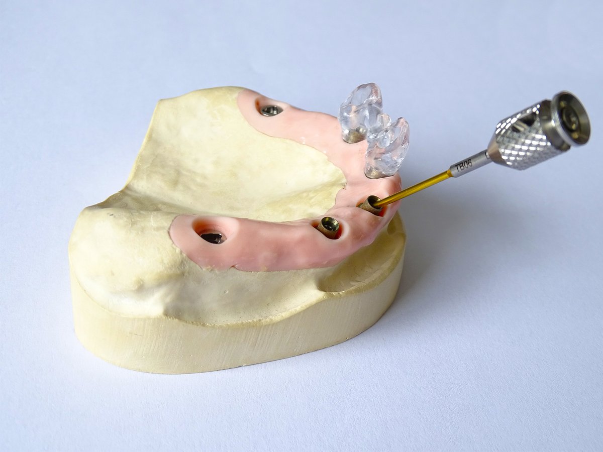 DessDentalSmart's tweet photo. Can’t find the perfect #screwdriver?

At #DESS we offer screwdrivers with multiple lengths to make your job easier. Our #TorxBall Screwdriver, specially designed to be used with #AURUMBase, is now available in a 30mm length. 

#dentalabutments #dessdental https://t.co/HCIbGAVMLF