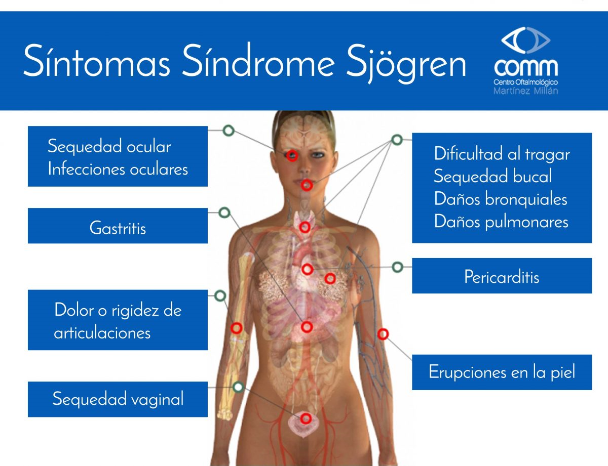 Ileitis sintomas