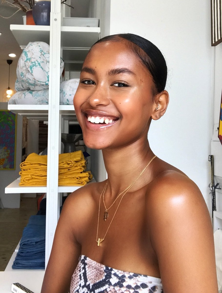AthiMtongana's tweet photo. 22-year Amber from Atlanta, Georgia (USA) has a one in 2 million underlying condition. It is triggered by toxic epidermal necrolysis (TEN), read her story below. #BeComfortableInYourSkin https://t.co/WakVjv4bxF
