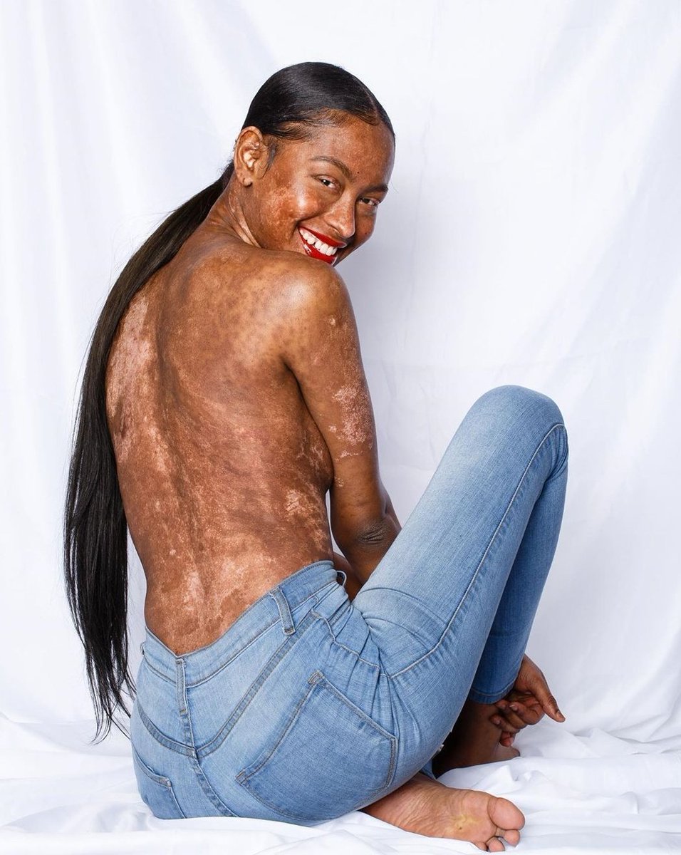 AthiMtongana's tweet photo. #BeComfortableInYourSkin https://t.co/tzbCU136Ni