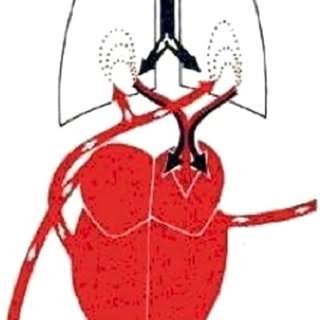 IBN-NAFIS : Discovered Pulmonary Circulation, Coronary Circulation, Capillary Circulation, Pulsation, One of the first to give the anatomy of Lungs proved that the brain, rather than the heart, was the organ responsible for thinking and sensation.