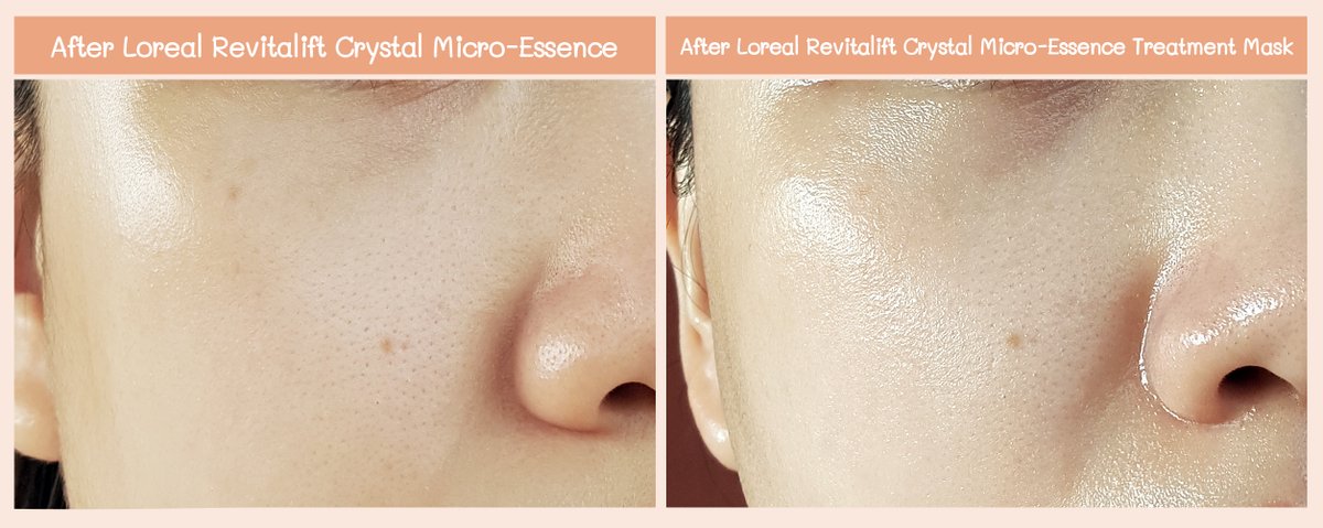lonelycindie's tweet photo. งานผิวละเอียด L'oreal Crystal Micro Essence และ Treatment Mask รู้สึกเลยว่าผิวชุ่มชื้นขึ้นมาก ตัวเอสเซนส์คือซึมไว ในขณะที่มาสก์ชุ่มชื้นนาน มาสก์วันนี้พรุ่งนี้ผิวก็ยังนุ่มฟูอยู่ บำรุงล้ำลึกจริง รูขุมขนแลดูกระชับอย่างเห็นได้ชัด คือผิวดี ผิวเปล่งปลั่งกระจ่างใสอะ #ดีบอกต่อ https://t.co/Fj8TFB7WIb