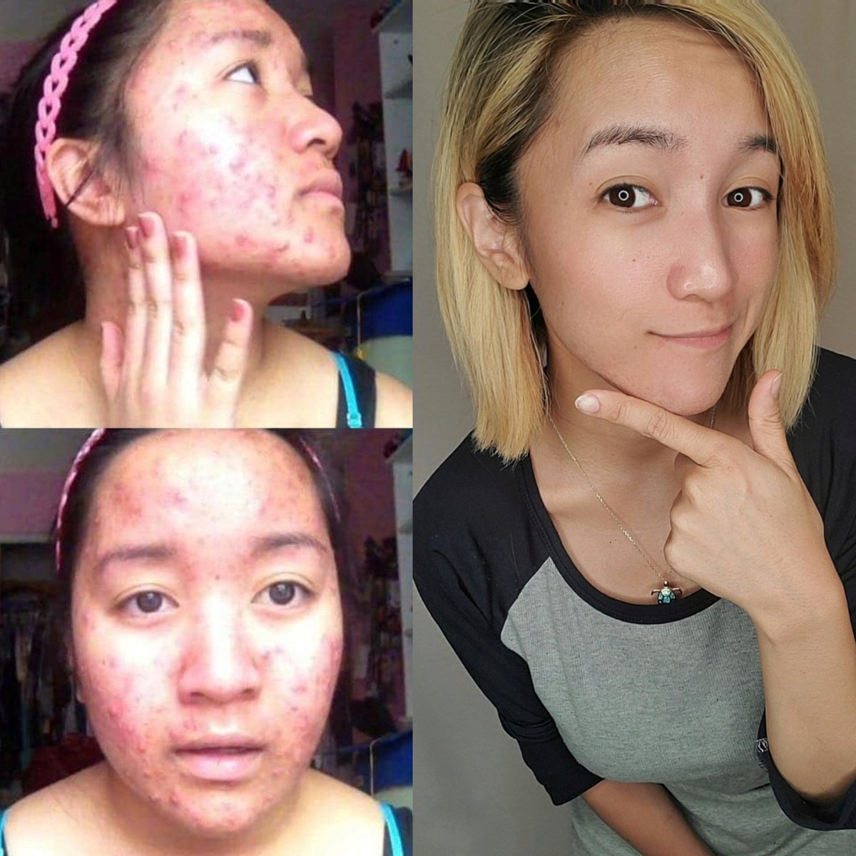 Been seeing a lot of 2015 vs 2020 posts going around and wanted to share mine! I get a lot of comments everyday saying I'm "livin' life on ez mode bc you're pretty" but here to tell ya that it was something I worked hard for! And you can too! 