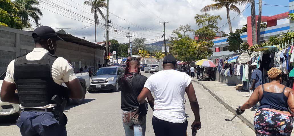 JahBFeray's tweet photo. 2 volè friz dam sa kap sot labank yo pran kob la. Yo te sou moto li suiv yo e fonse sou yo. Youn tonbe lòt la kouri. Manze te gonw mache li bay sak tonbe a 3 kout machet youn nan kou. Pandan l pral touyel lapolis paret.yo jwenn lòt la pi devan https://t.co/gh2j4etlXL