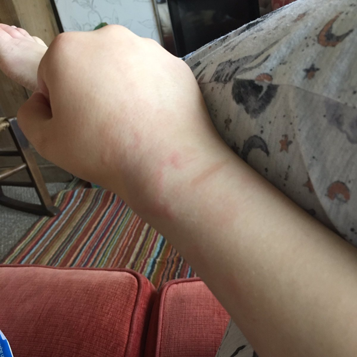 The steroids worked almost immediately. However, the hives kept coming back just before the next dose. I decided to taper this course much more slowly, to give my body a change to adjust.