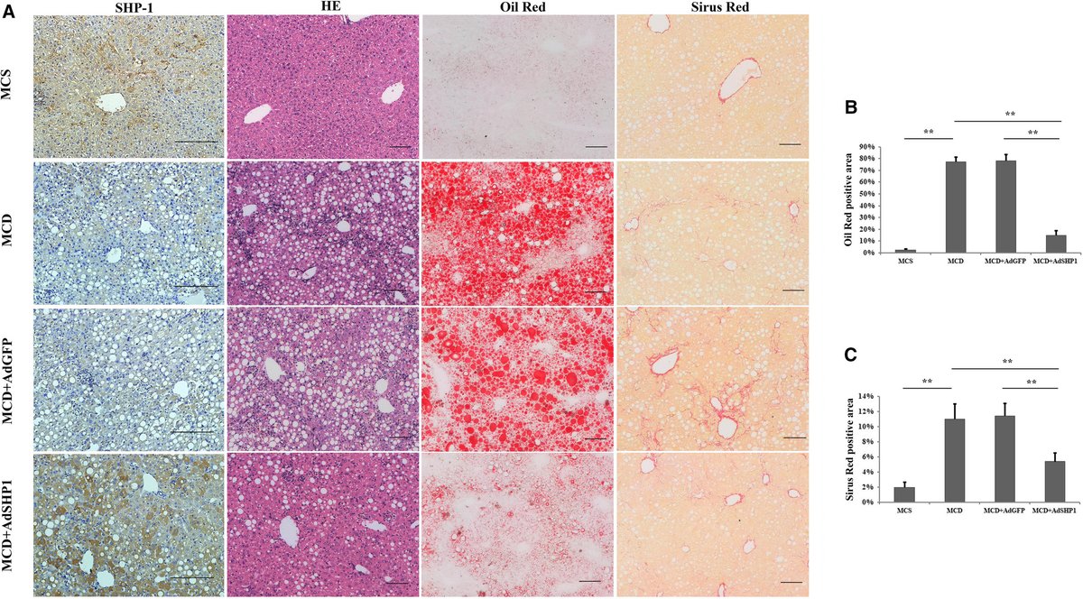 FEBS_Letters's tweet photo. Study using #hepatocyte-specific SHP-1 (aka PTPN6) #knockoutmice reveals that it ameliorates #NonalcoholicSteatohepatitis by inhibiting proinflammatory cytokine production →https://t.co/0u1VReGSgW #inflammation #liverfibrosis #NAFLD https://t.co/Xj17b0TYlW