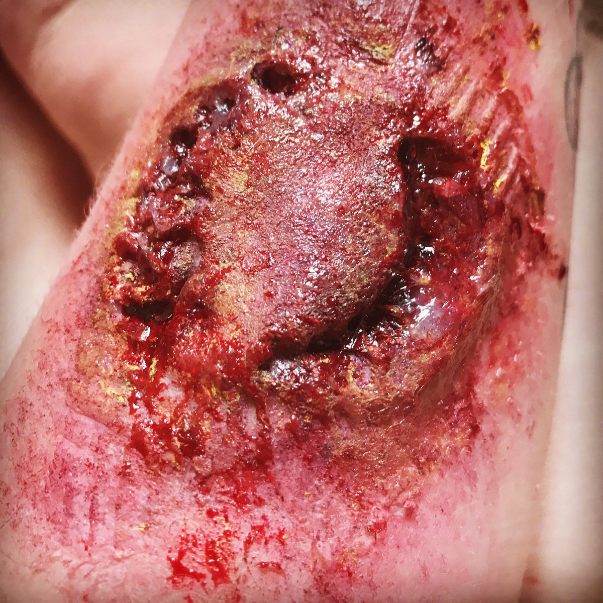 JasmineSfx's tweet photo. Zombie bite, made incisions with my own teeth to make it as accurate as possible #Zombie #Zombiebite #apocalypse #Virus #SFX #Specialfx #Movie #Gore #Infection https://t.co/6Ei6KB3TBh
