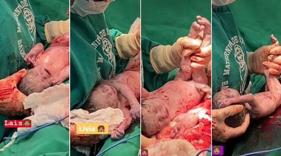 g1's tweet photo. 👶👶👶+👶 Mãe que esperava trigêmeas descobre quarta filha 'surpresa' na hora do parto em Manaus https://t.co/6hGNQvWUG2 #G1 https://t.co/FO22SaxT9V