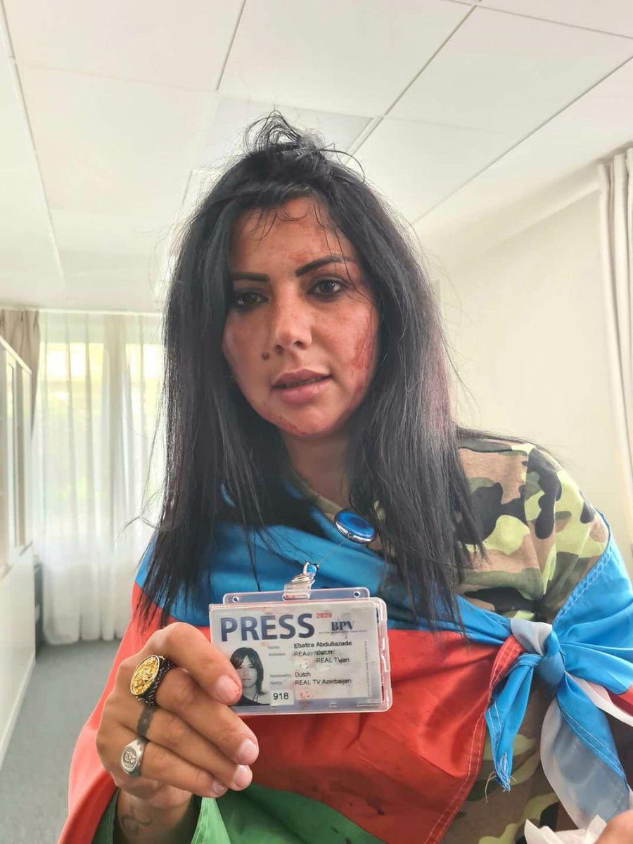 aliyevaysun's tweet photo. Gestern wurde die aserbaidschanische Reporterin Khatira Abdullazade vor der aserbaidschanischen Botschaft in Belgien @realtvxeber von Armeniern schwer verletzt    Diese Diskriminierung und Aggression muss gestoppt werden!   #KIAZteam #BeFairForAzerbaijan #AzerbaijanWantsJustice https://t.co/GPTYJQlQSM