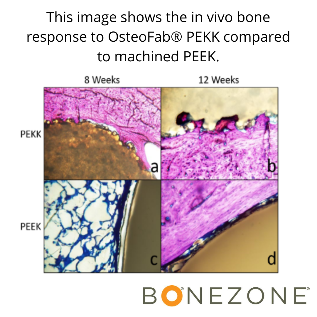 OMTEC_BONEZONE's tweet photo. @FDADeviceInfo is no longer grandfathering classic alloys for use in medical devices. Will this drive the development and adoption of newer, more innovative materials for #orthopedics? Read about one such material here: https://t.co/piuUUflmiE https://t.co/KT4xW7SaqD