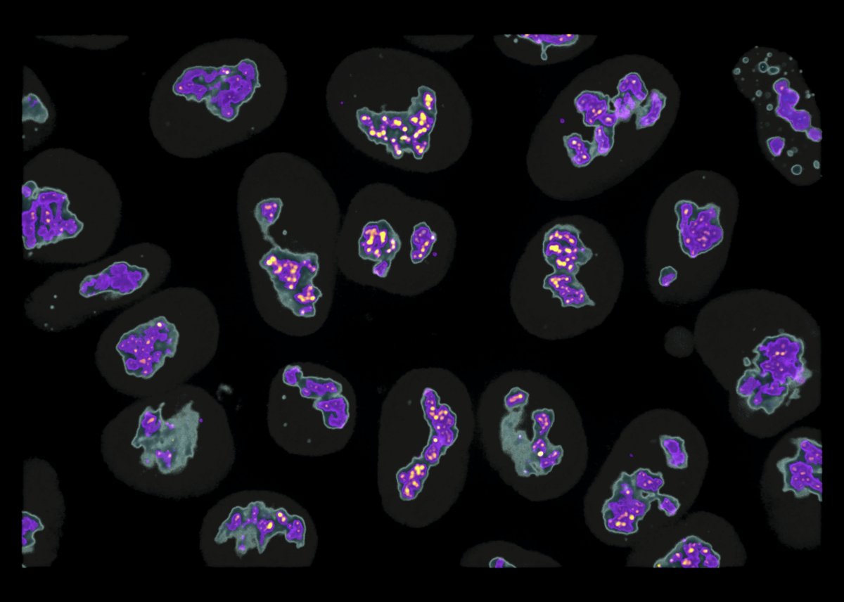 AllenInstitute's tweet photo. This 3D image of live cells was acquired on a confocal microscope was rendered using AGAVE (https://t.co/xscKWHfRSS). Pseudocoloring shows the granular component in grey, the dense fibrillar component in blue, and the fibrillar center in yellow. #AllenCellCollection https://t.co/J2LkbDODbR
