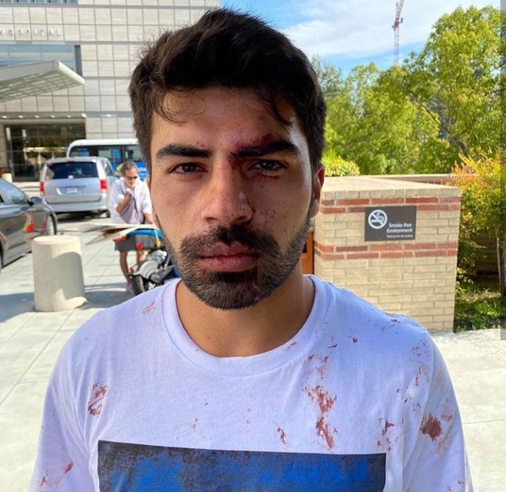 A15864425's tweet photo. Daha nə qədər dözəcək bu xalq bu zülmə??
#StopArmenianAggression #KarabakhisAzerbaijan #Azerbaijan https://t.co/qOR3DCvs5X
