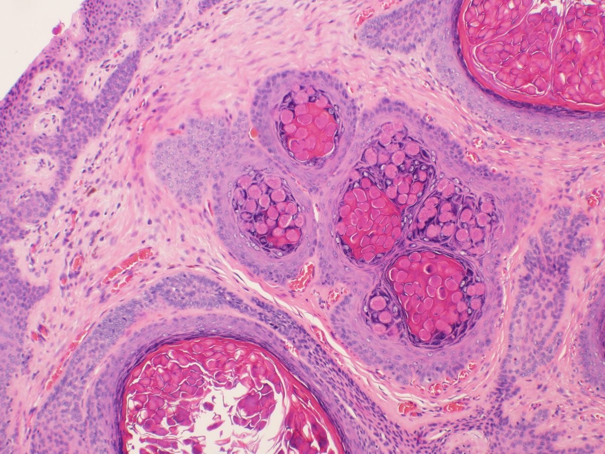 CUpathology tweet media