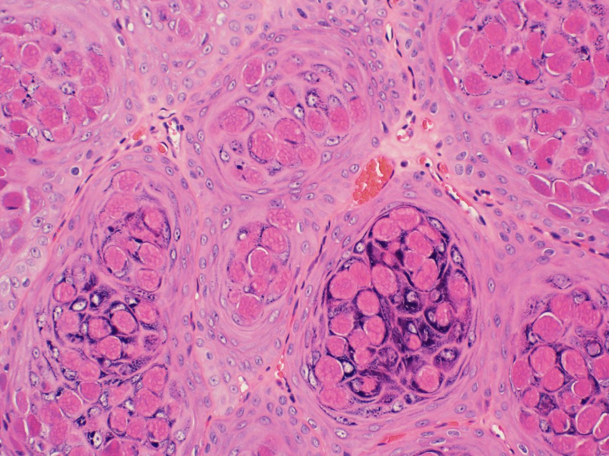 CUpathology tweet media