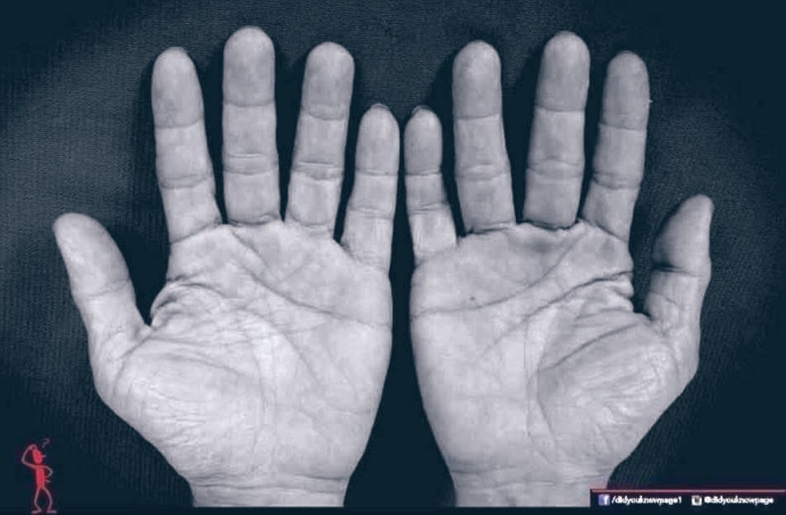 allabout_aatif's tweet photo. Never believe the lines of your Hands that predict your future. Because even people without hands also have Future;

JUST BELIEVE IN YOURSELF ✌🏻 https://t.co/l8M513ZoAT