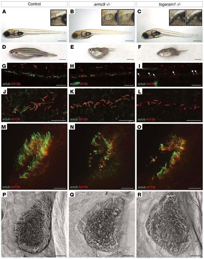 Journal of Clinical Investigation (@jclinicalinvest) on Twitter photo Dysfunction of the ciliary ARMC9/TOGARAM1 protein module causes Joubert syndrome: buff.ly/2OIy03H 
<a href="/JulieCVDW/">Julie Craft Van De Weghe, PhD</a> <a href="/blalatour/">brooke latour</a> <a href="/Dohertylab/">Dan Doherty</a> <a href="/RoepmanLab/">Roepman Lab</a> #Genetics Dysfunction of the ciliary ARMC9/TOGARAM1 protein module causes Joubert syndrome: buff.ly/2OIy03H 
<a href="/JulieCVDW/">Julie Craft Van De Weghe, PhD</a> <a href="/blalatour/">brooke latour</a> <a href="/Dohertylab/">Dan Doherty</a> <a href="/RoepmanLab/">Roepman Lab</a> #Genetics