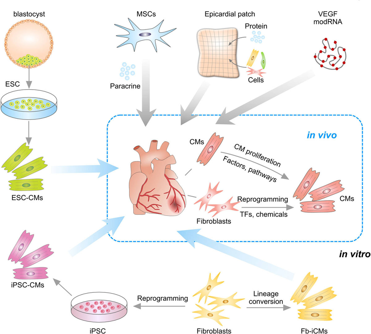 CircAHA's tweet photo. InDepth: Heart Regeneration by Endogenous Stem Cells and Cardiomyocyte Proliferation: Controversy, Fallacy and Progress https://t.co/4f7kW3cHDW #AHAJournals https://t.co/7TwzuBm2oP