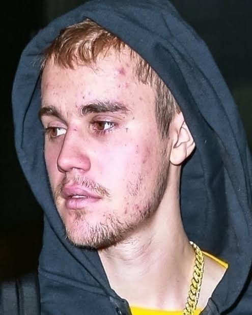 JByazminn's tweet photo. estoy tan orgullosa de justin. el realmente obtuvo ayuda para su piel, mirenlo más confiado de mostrarnos su carita 😭😭

BIEBER IS COMING https://t.co/cqhJalKE89