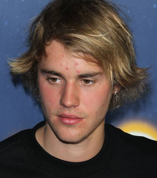 JByazminn's tweet photo. estoy tan orgullosa de justin. el realmente obtuvo ayuda para su piel, mirenlo más confiado de mostrarnos su carita 😭😭

BIEBER IS COMING https://t.co/cqhJalKE89