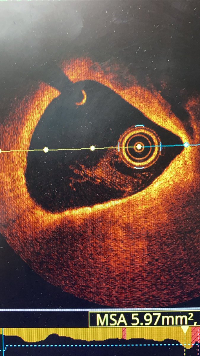 Arvin Narula tweet media