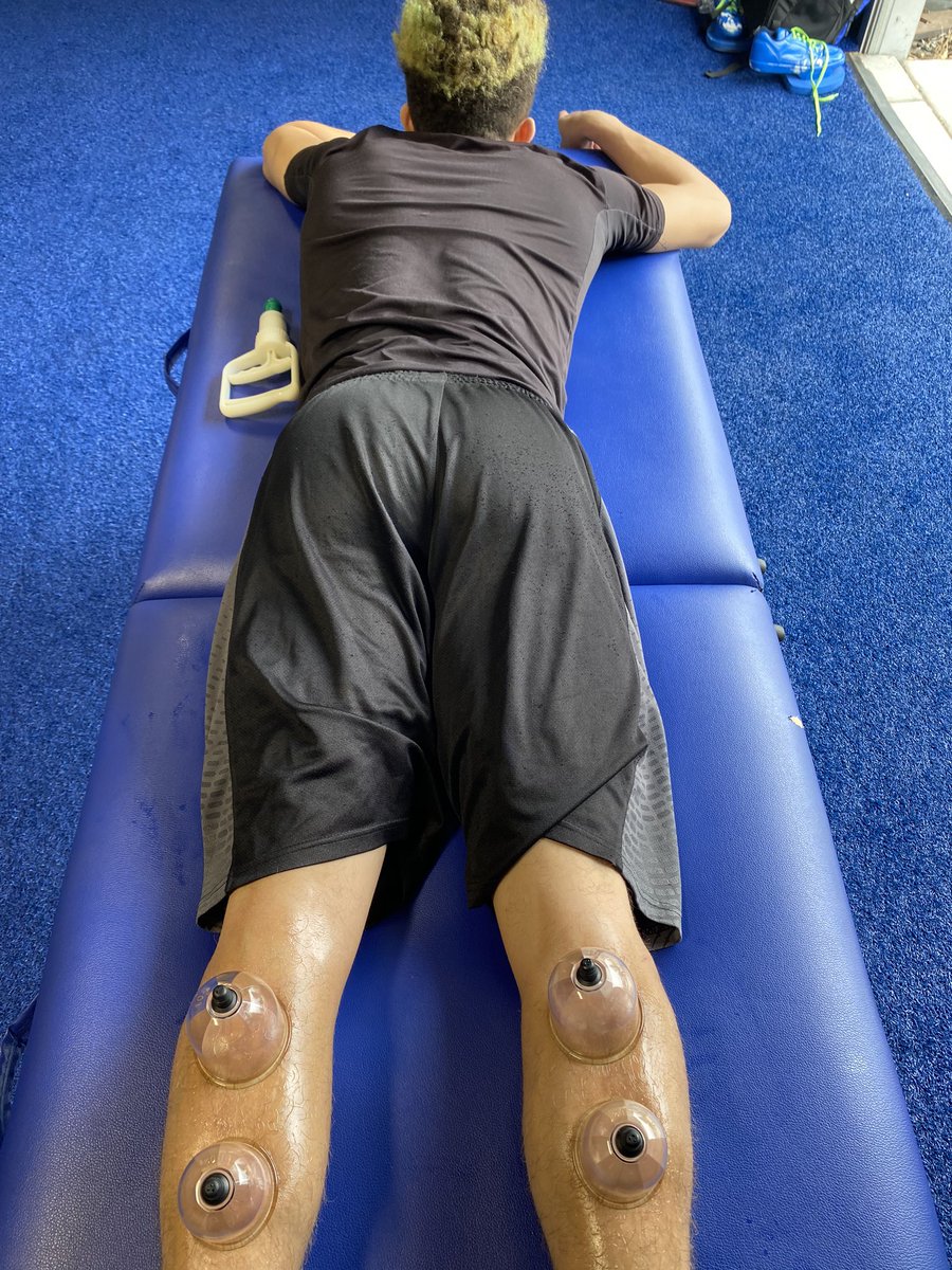 EAthletix's tweet image. Post Workout With Deville “Joker” Dickerson (Lompoc) #LegRecovery #TrainHard #RecoverHarder #CuppingWarehouse @EliteAthletix  @Deville2404 @LowKash01 @CuppingWarehous @Tiffany43237088