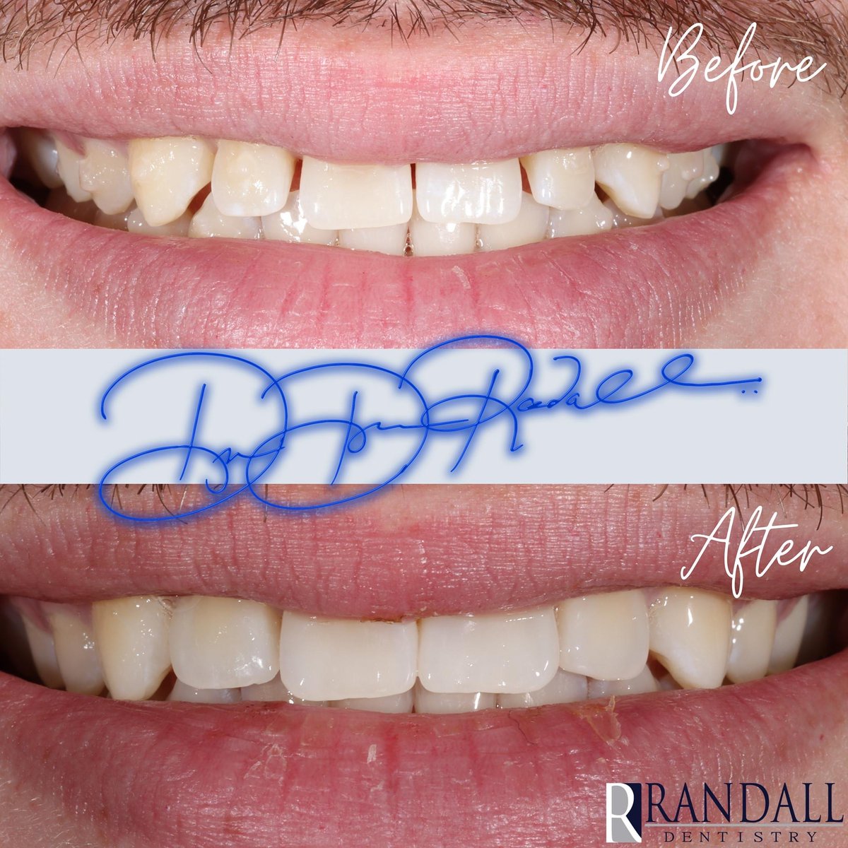 Dr. Drew Randall | Randall Dentistry | Dallas, TX tweet media