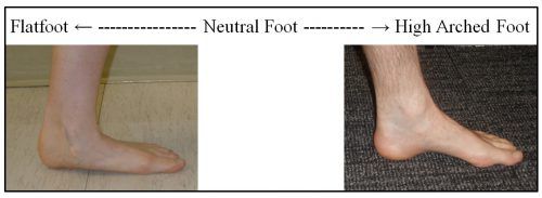 footEducation's tweet photo. #DYK ? #Foot types follow a basic spectrum that ranges from a flatfoot on one end, to a high arched foot on the other! What's your #foottype? https://t.co/gH82iT3S9M
#footeducation #orthoeducation #FOAmed https://t.co/eQ3iUdaMad