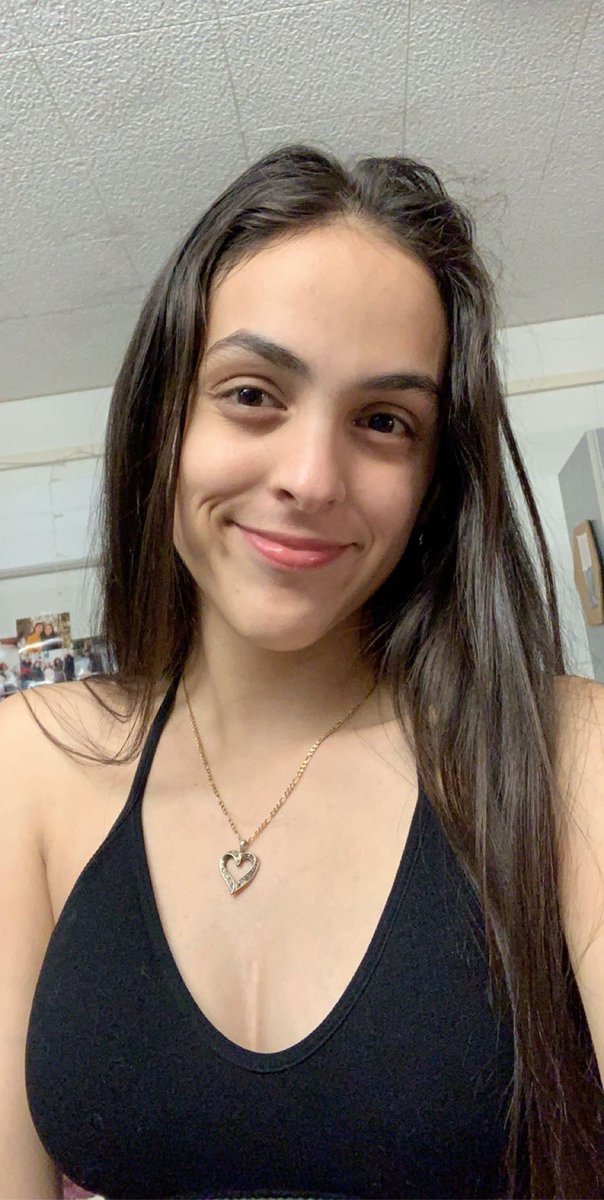 reynacamarena_'s tweet photo. growing up with lots of surgery scars was hard but i’ve learned to love them. i saw myself as imperfect & was so self conscious of how others would see me and now, i realize that i was born a fighter & no one is going to belittle me for my fight for life. #MyBodyIsBeautiful https://t.co/iqyuvrHUPr
