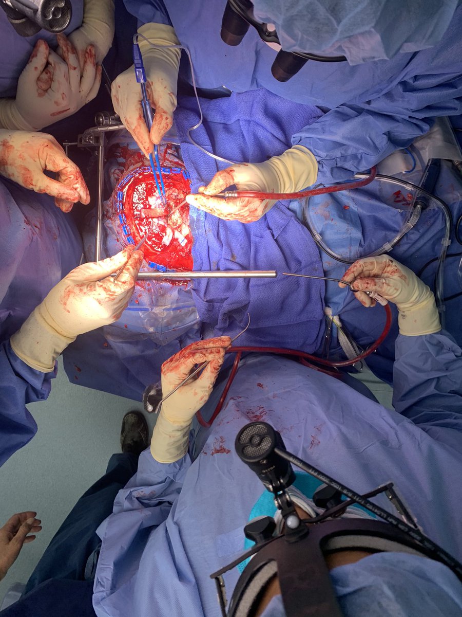 drdavidlanger's tweet image. Day 3/7, a neurosurgeon’s life in pictures (no words). Nominated by @EladLevyMD . Today I nominate my longtime friend @vajkoczy @ChariteBerlin