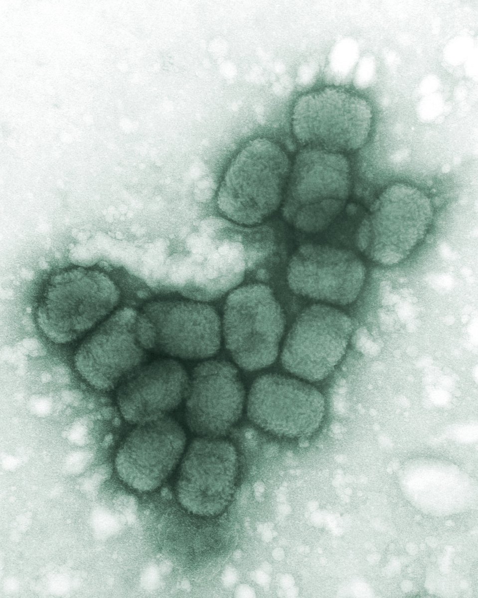DZIF_'s tweet photo. Schon die Wikinger hatten Pocken - beweist eine neue Studie zur Evolution des #Pockenvirus in @ScienceMagazine
Erstautorin ist #DZIF_Wissenschaftlerin Dr. Barbara Mühlemann an der @ChariteBerlin
https://t.co/N4W0KHbe04
#pocken https://t.co/8orDu6ItW3