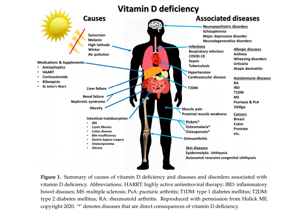 PushkarGupta's tweet photo. Vitamin D supplements are need of the hour for your immunity &amp; health, recent study from Dr Hollick on Immunologic Effects of Vitamin D on Human Health &amp; Disease

- https://t.co/XUDLslgxcS

#VitaminD4Health #VitaminD #VitD #health #CalcirolD3 #Covid_19 #immunity #sunshinevitamin https://t.co/D5FTNvPpGs