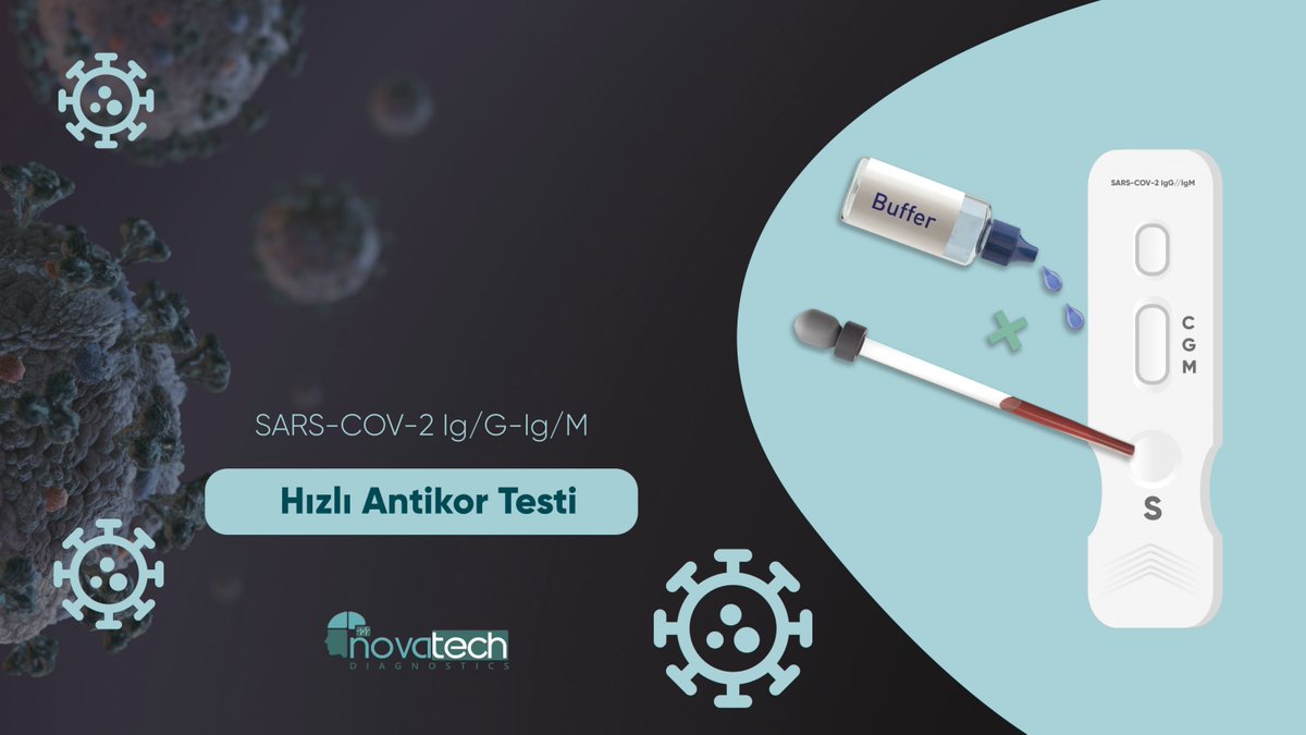 GaziantepTO's tweet photo. Gaziantep ve bölgemiz adına bir ilki gerçekleştirerek Covid-19 Hızlı Antikor Testi üretmeyi başaran Novatech Diagnostics Y.K. Başkanı @EczEnginBicer ve İşletme Müdürü Erdal Kıratlı Odamızı ziyaret ederek bu alanda yapılacak iş birlikleri hakkında görüş alışverişinde bulundu. https://t.co/557e6CEwFH