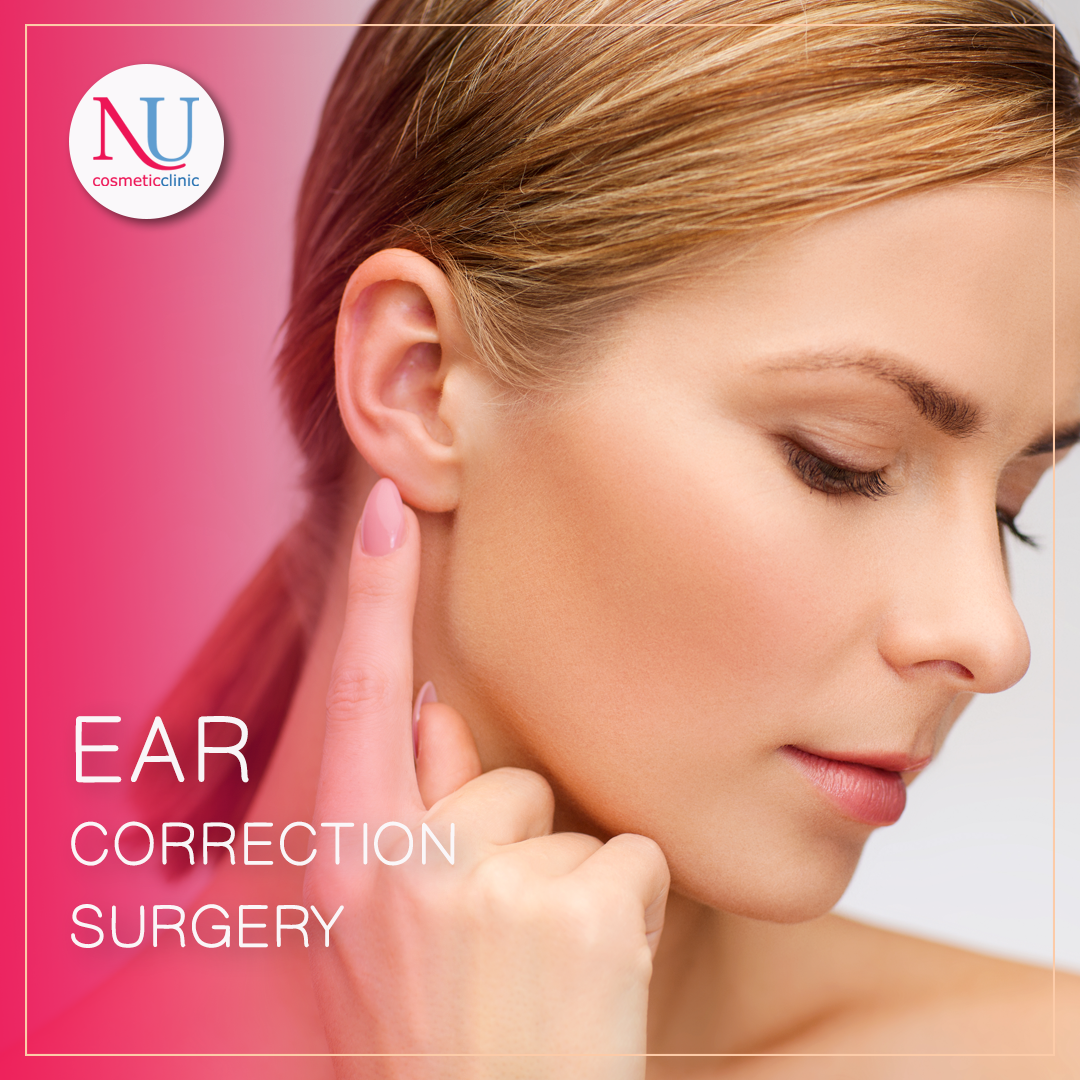Do you have a deformed ear? Have you considering for Ear correction surgery?
 
Ear correction surgery is cosmetic surgery to alter the size or shape of the ears, or pin them back if they stick out.
 
For more information about #otoplasty procedure 👉 buff.ly/3g9NA4J