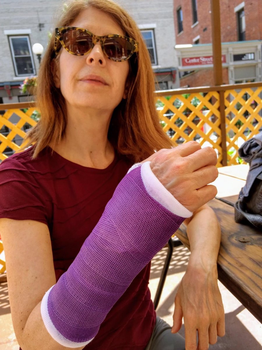 CynthiaSayer's tweet photo. I fell off of a children’s zip line and broke my wrist. Dammit. It will heal with no harm to my playing, thank goodness. At least the purple cast is cool. https://t.co/IfAuLf74DX