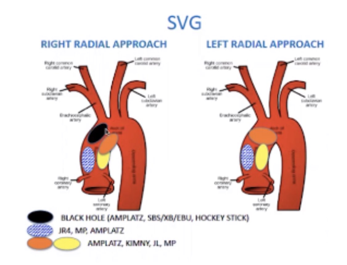 GuptaRMD's tweet photo. Take advantage of @SCAI TRAsition for Value #RadialFirst modules available free:
https://t.co/49FupLAPnM
Excellent curation of #PCI modules by @ARS_MD2004 & @SVRaoMD
Learn to traverse the black hole of guide engagement in #SVGPCI from Rt radial! https://t.co/wjext0JWn9