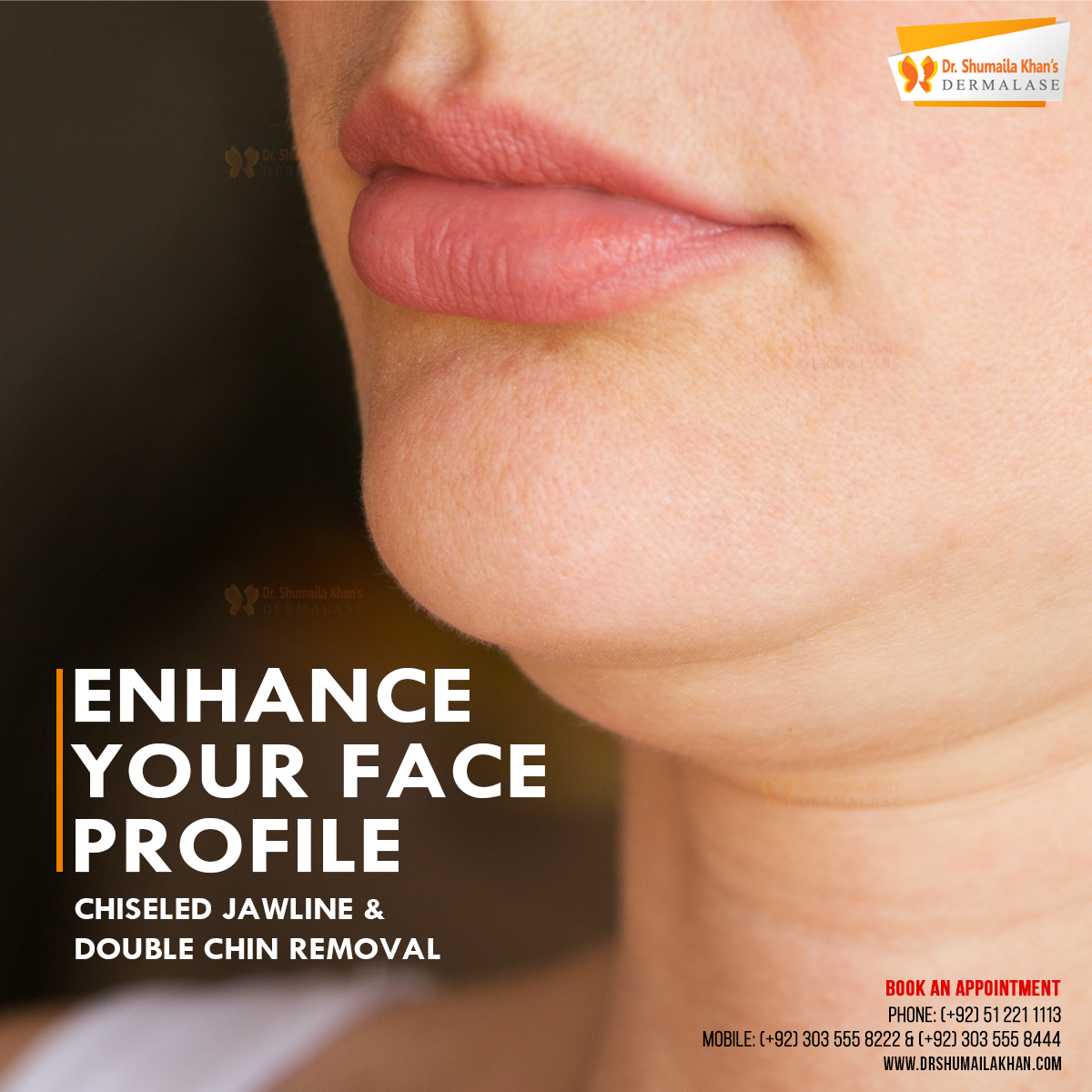 DrShumailakhan's tweet photo. For inquiries or to book a consultation, please call on (+92) 51 221 1113, (+92) 303 555 8222, (+92) 303 555 8444 or visit https://t.co/LLq0vLRnD9.

#chiselledjawline #lowerfacecorrection #jawangle #HAfillers #ellanse #facialrestructuring #featureenhancement #nonsurgicalfacelift https://t.co/1usaiYna3s