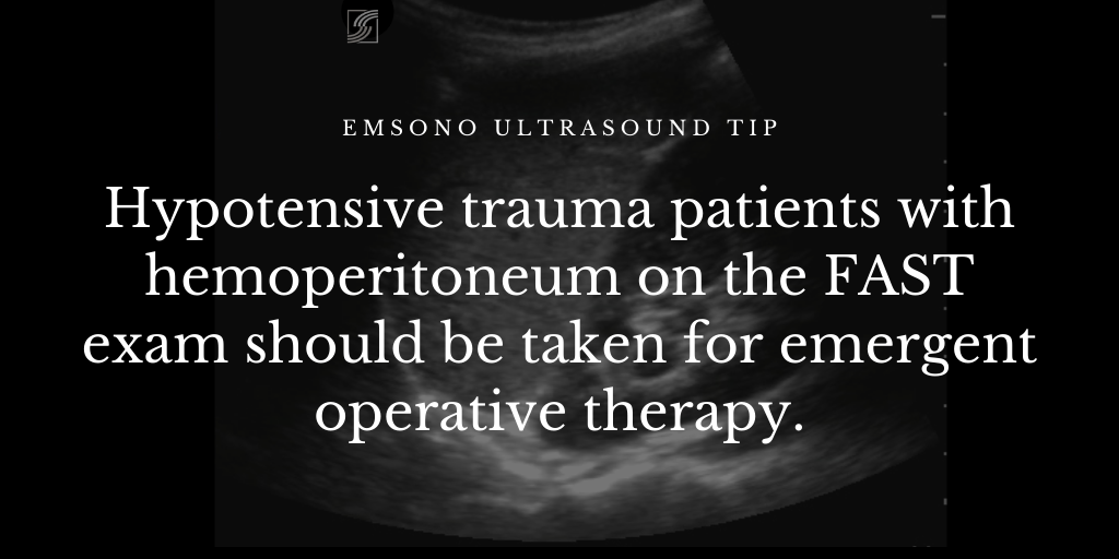 EMsonoPOCUS's tweet photo. EMsono Ultrasound Tip - Hypotensive trauma patients with hemoperitoneum on the FAST exam should be taken for emergent operative therapy. #EMsono #FAST #POCUS https://t.co/6a2hqYqlkW https://t.co/PcoGusMhNf