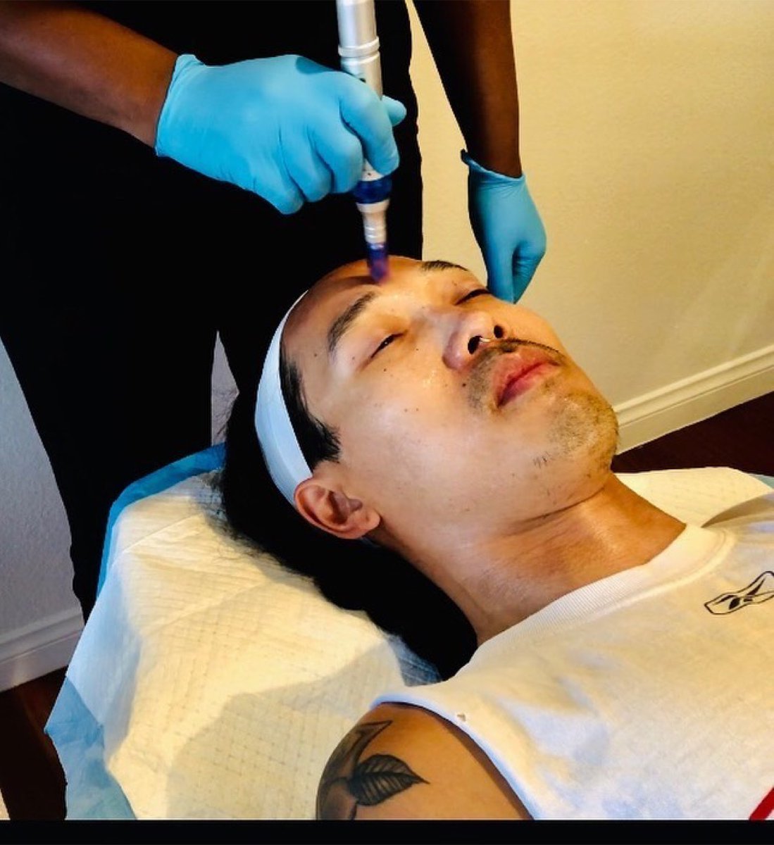 juventix's tweet photo. #Microneedling with #PRP is for men too!  For men who are looking to rejuvenate their skin, improve collagen production and remove acne scars, a microneedling with #PRPfacial may be just what you’re looking for. 

To purchase visit our website, https://t.co/zhaxCos0tv

#Juventix https://t.co/YKha6H5AFZ