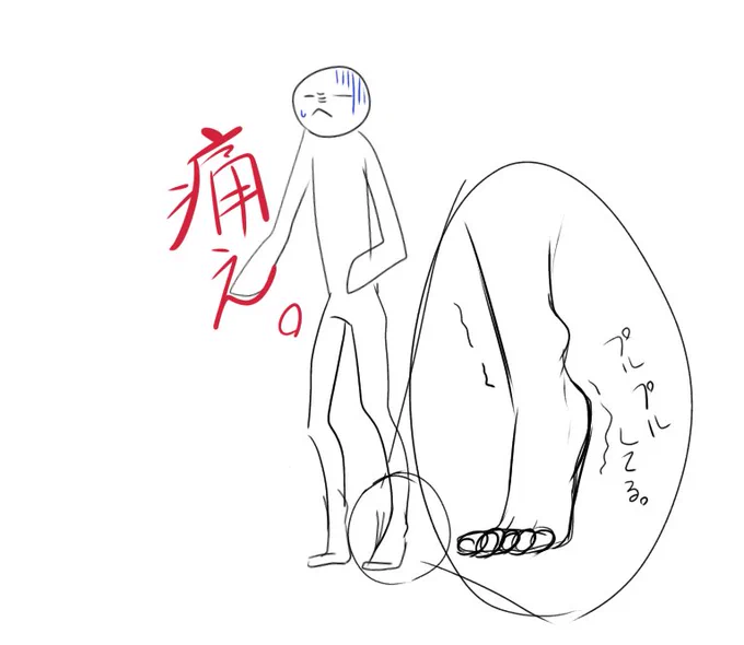 マジでアキレス腱痛くて【ティラノサウルス歩き】してる。 