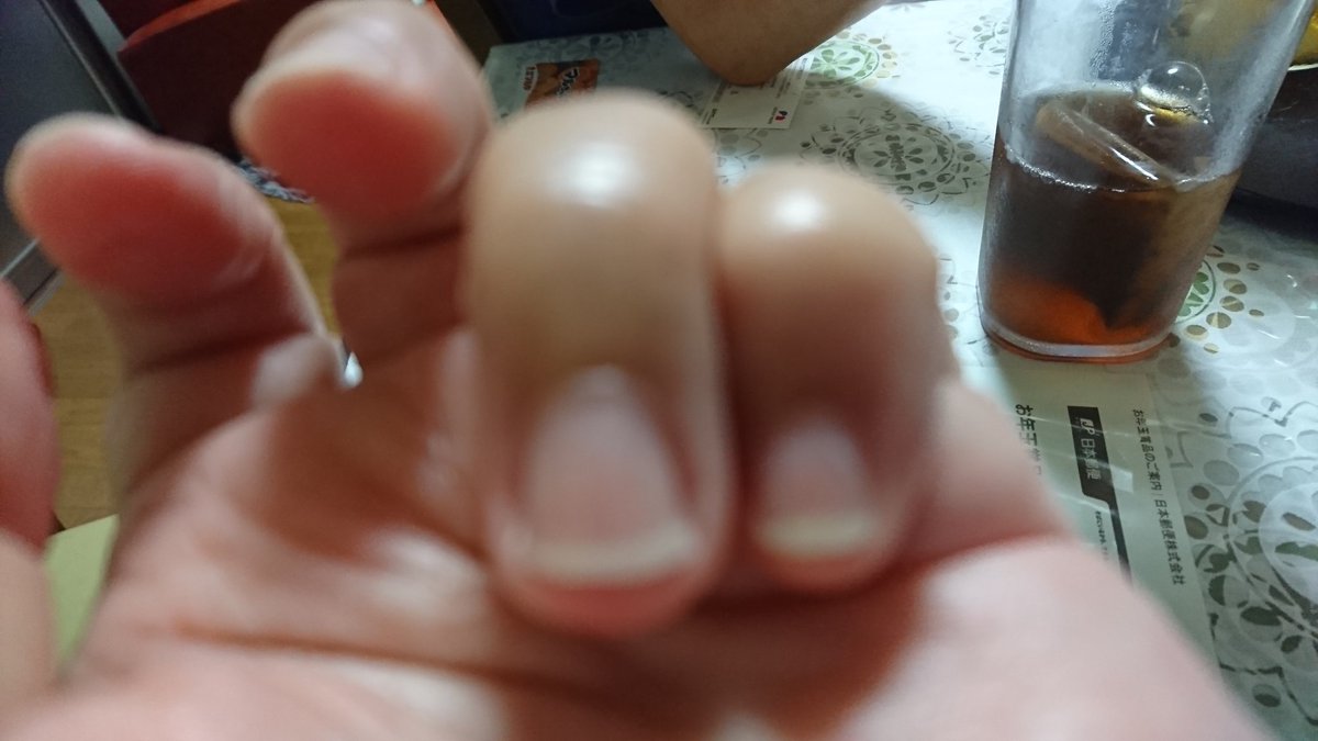 爪を伸ばした事ない&amp;
もちろん禁止なんだけど…
ネイルの長爪って…
どうやって洗うの？
消毒するの？
#爪
（あたしに詰め寄った人の爪）