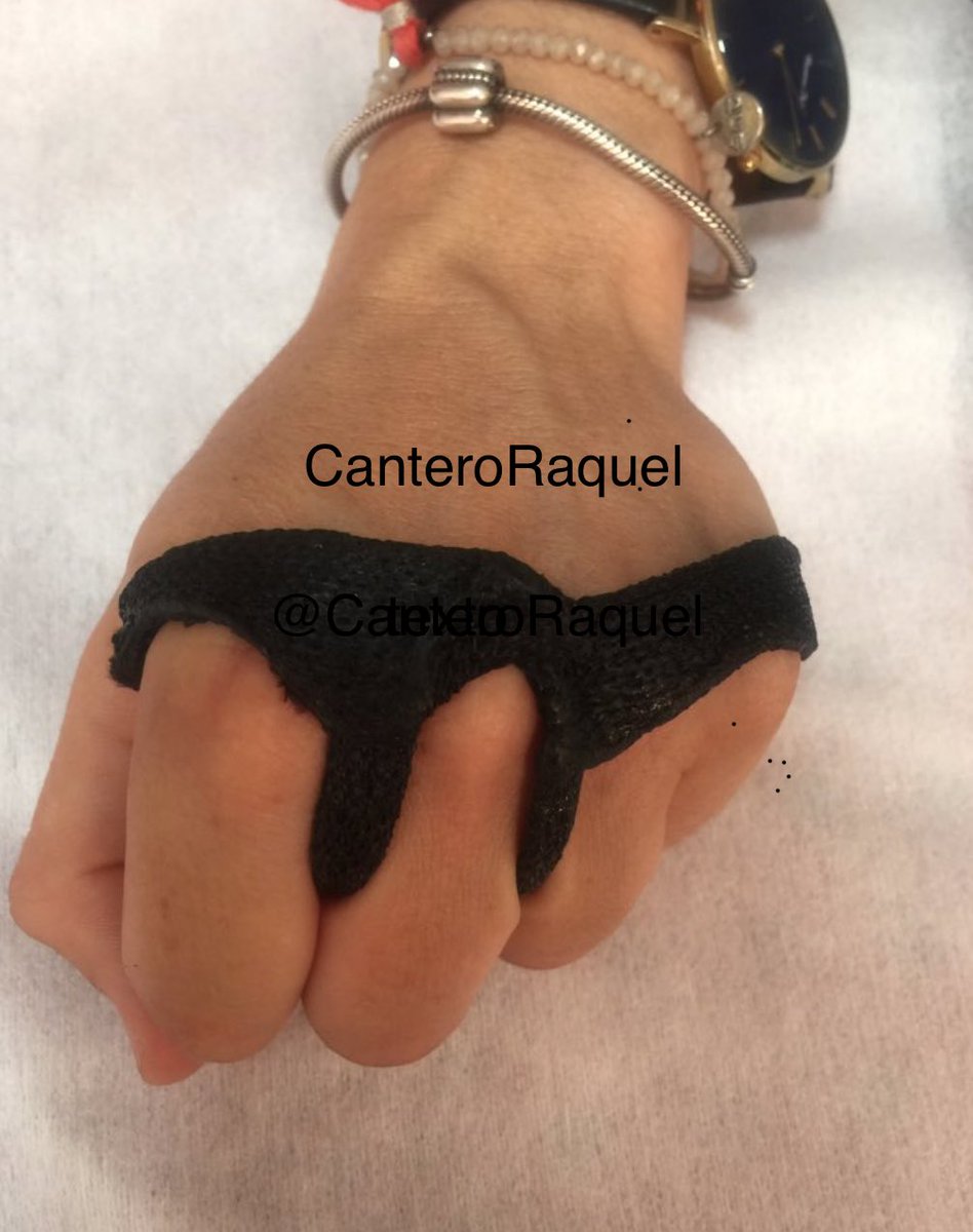 CanteroRaquel's tweet photo. De forma forma sencilla puedes estabilizar la MCF para una actividad como en crossfit. #terapiademano #handtherapy #handorthosis https://t.co/iaG7vxBvCV