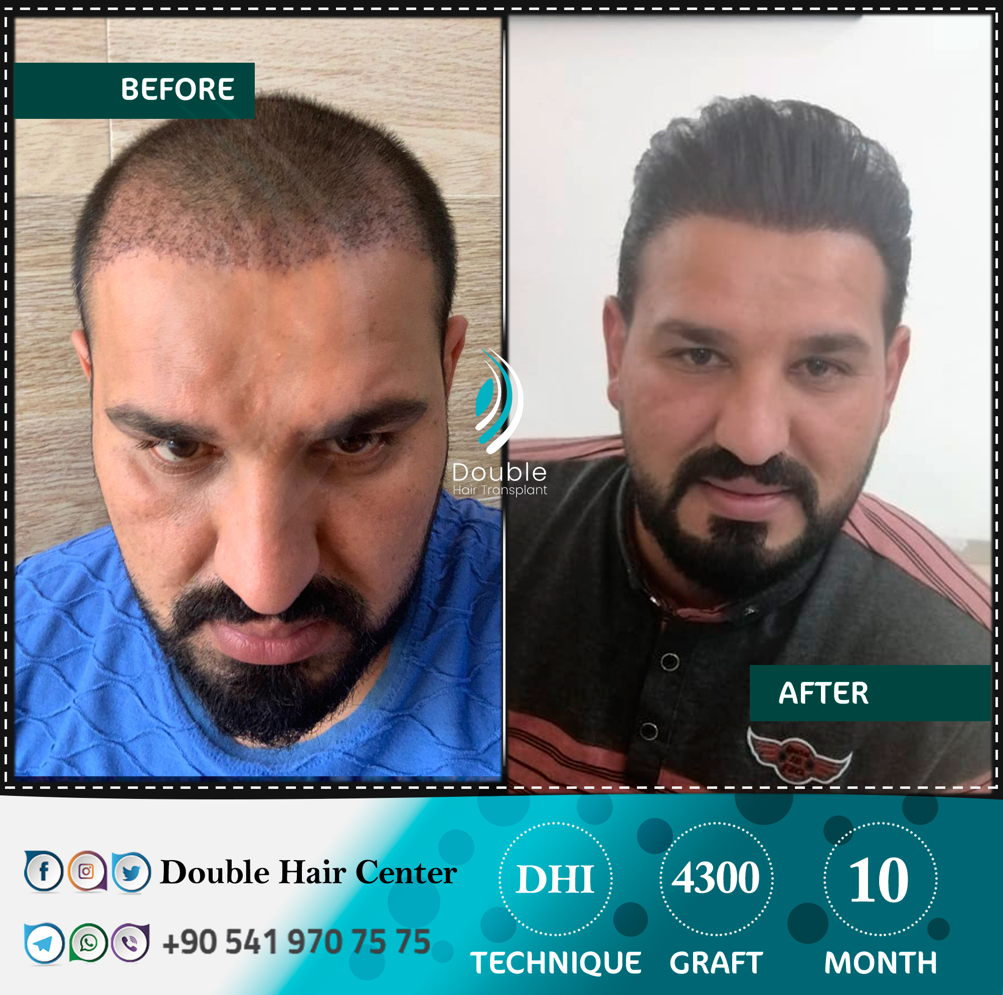 Double Hair Center on Twitter: Double Hair Center on Twitter: