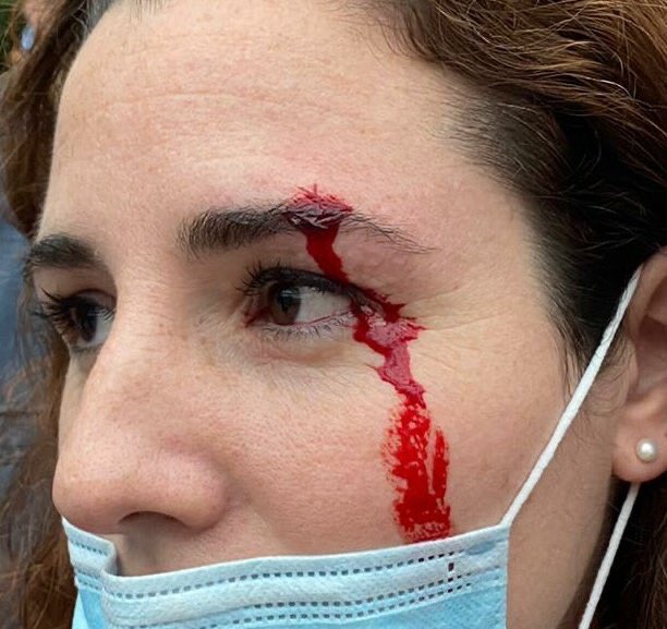 FonsiLoaiza's tweet photo. Rocío de Meer, diputada de VOX, dijo haber recibido una "pedrada" en Sestao. Los medios de comunicación publicaron sin contrastar que fue agredida. Al día siguiente no tenía rasguño alguno. Hoy, Fiscalía ha archivado la denuncia de la supuesta agresión por ser un burdo montaje. https://t.co/77LZh5EeIr
