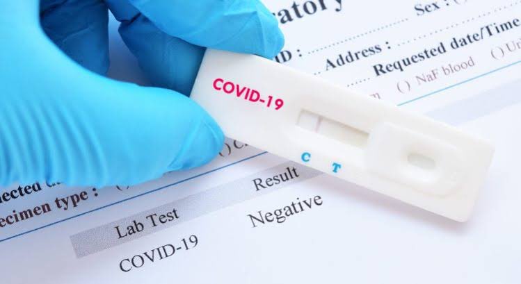 Support to counties for quick turnaround for  #COVID19 results which means putting up shared capacities through regional testing hubs. Sending samples to Nairobi with 4-7 day turnaround won’t cut for a highily infectious disease