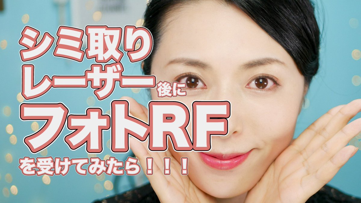 和希 優美 かずき ゆみ Yumi Kazuki シミ やそばかす フォトrf で施術後の14日間経過撮影 シミ取りレーザー 後のシミはどれだけ取れるか検証 T Co Cad6ruj2x4 納豆がとにかく好き 出身地を名前を出さずに匂わせる オーロラ シミ