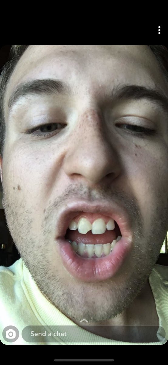 ry_anal's tweet photo. x2 https://t.co/zCLbAilfYu