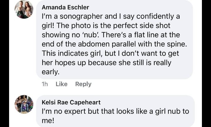 iamsonjaleigh's tweet photo. Yesterday we had our third ultrasound, second time this week.
However our second ultrasound the tech sneaked in a nub shot aka a possible key to our babys gender. A friend uploaded it to her group and this happened...

Our babys heart rate is 181 and I've been sicker than z 🌈🤰🏼 https://t.co/WlsnebIWej