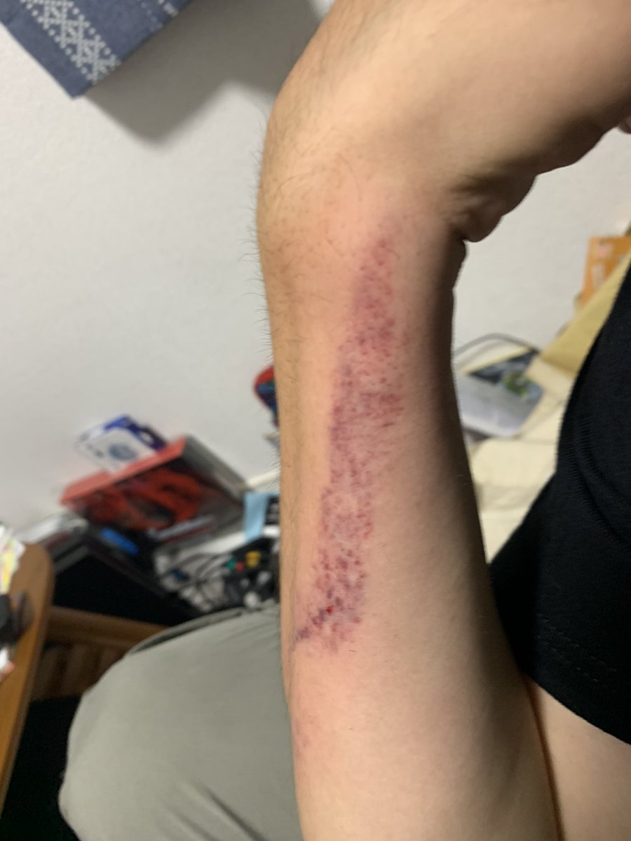 tkamioji's tweet photo. 大阪帰ってきて、いきなりコケてこの有様よ。。。
勘弁してくれ😭 https://t.co/5G9qCIZeKE