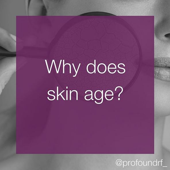 UpstatePlastic's tweet photo. Every time we smile 😀, frown 😣, or sit in the sunshine ☀️ , tiny grooves form under the surface of the skin. As we age, the skin loses some of it’s elasticity, and these small creases build up over time, resulting in wrinkly skin.  Bring the snap back with #ProfoundRF https://t.co/0IbSCNHcxA