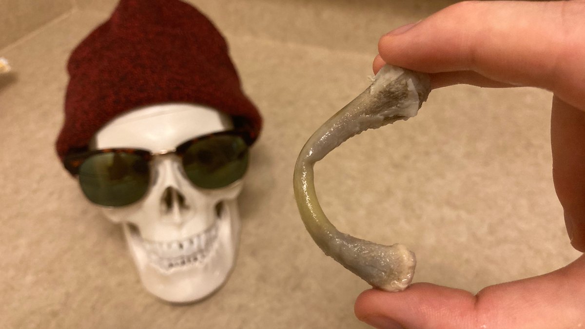 Drewboo830's tweet photo. @KateLesciotto ERMAHGERD, IT'S SOO BENDY NOW!!! I asked @ProfIndyBones if I could dunk him in vinegar next for a human trial run, but I don't think he was amused.🙅‍♂️💀 https://t.co/As7qpZZhoC